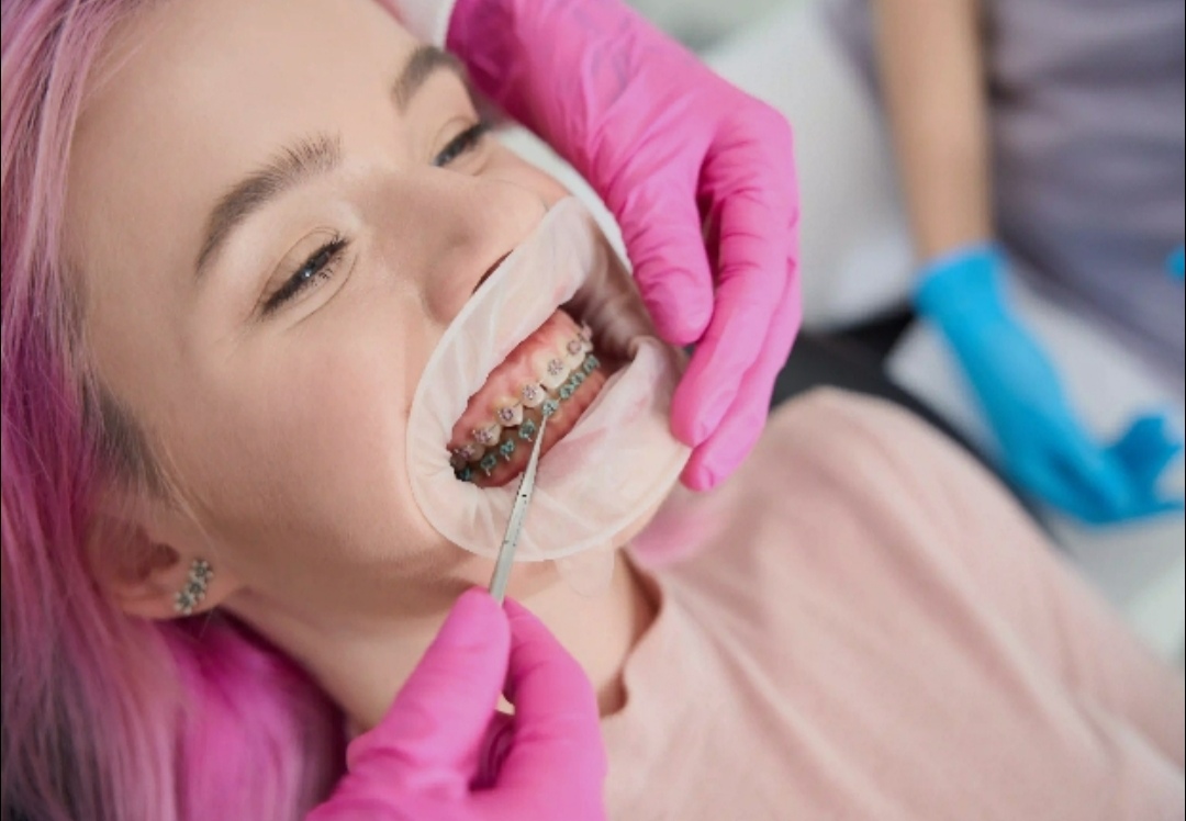 Orthodontics Treatment